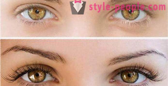 Apa yang bulu mata Botox? Gambar sebelum dan selepas, terutama prosedur
