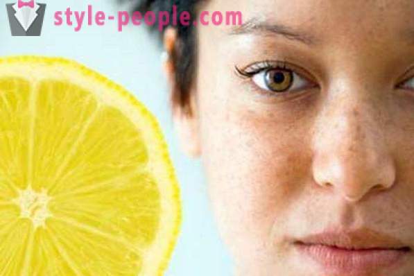 Bagaimana untuk menghilangkan freckles? ubat krim dan kaum yang Sangat freckles